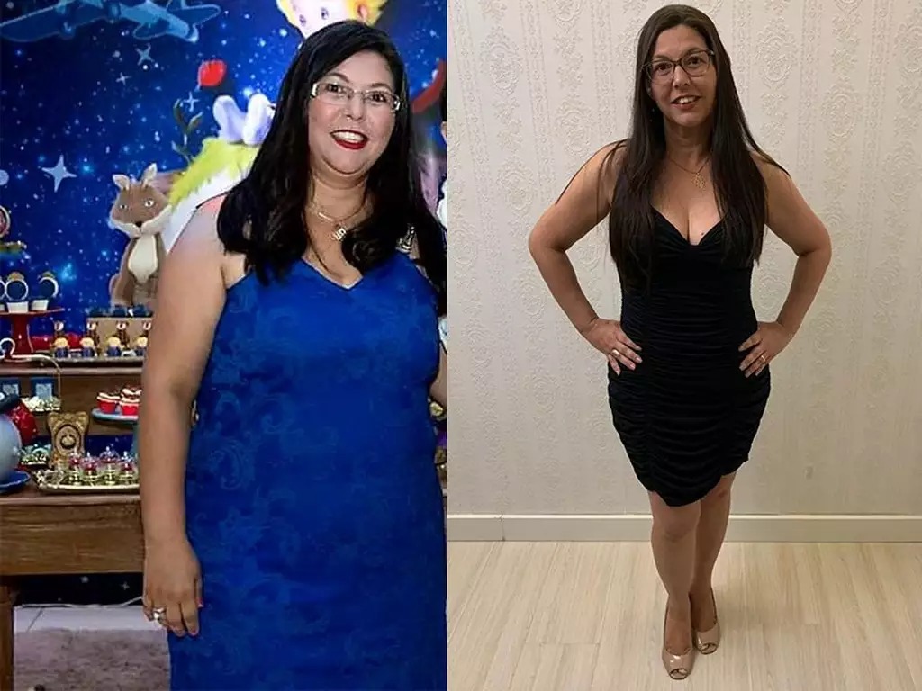Antes e depois 1