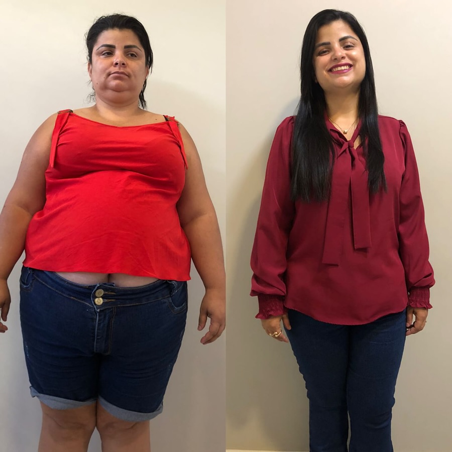 Antes e depois 4